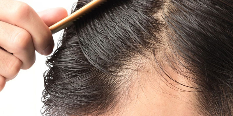 Ena Hair Clinic|Tıraşsız Saç Ekimi