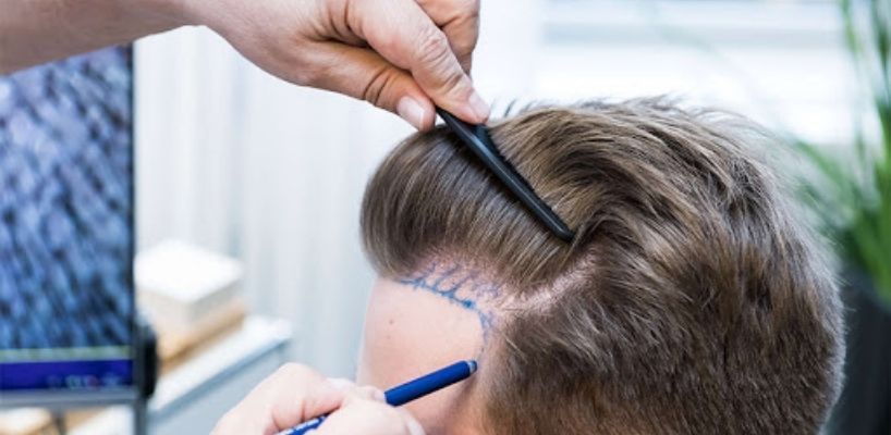 /blog/138/files/80ea4119-6955-400d-871b-462db23eb9c6.jpg | Ena Hair Clinic